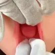 Fixed Tongue