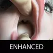Fixed Tongue
